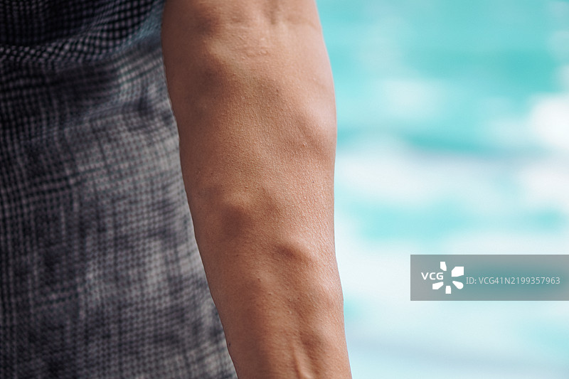 人手臂特写，展示静脉曲张和血管纹理图片素材