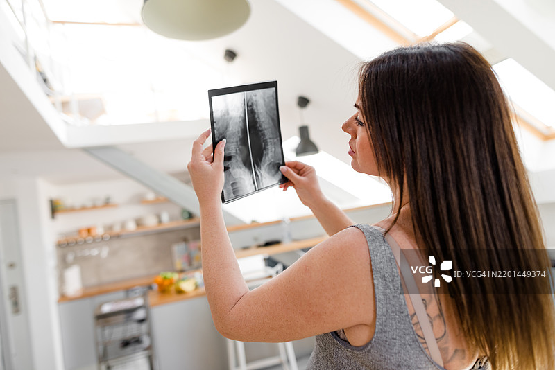 孕妇在观看她的X光片图片素材