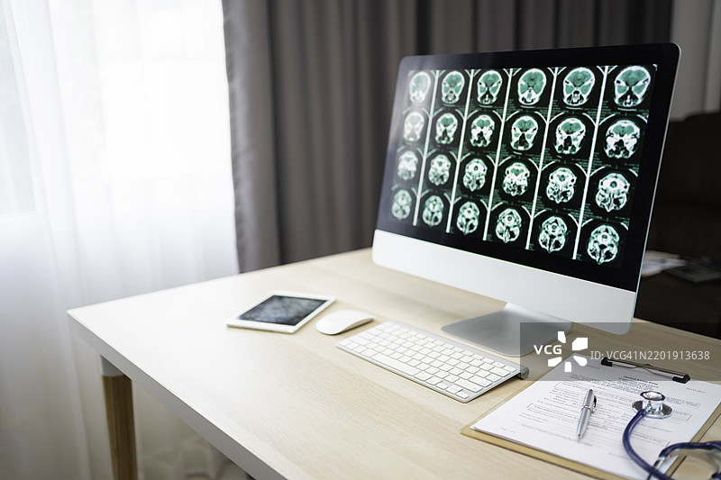 人脑的CT扫描，医学治疗概念，以及人头部疾病的诊断。图片素材