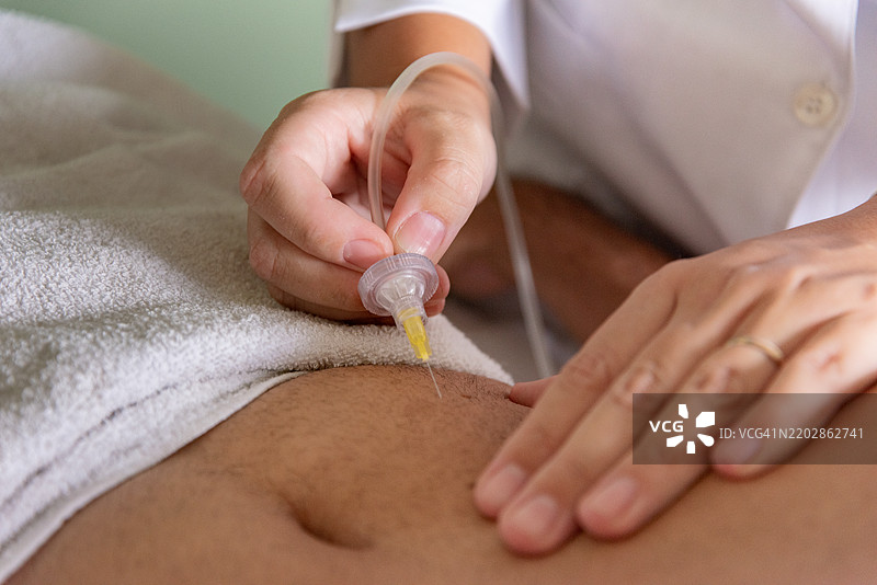 腹部的美容治疗，包括按摩和注射图片素材
