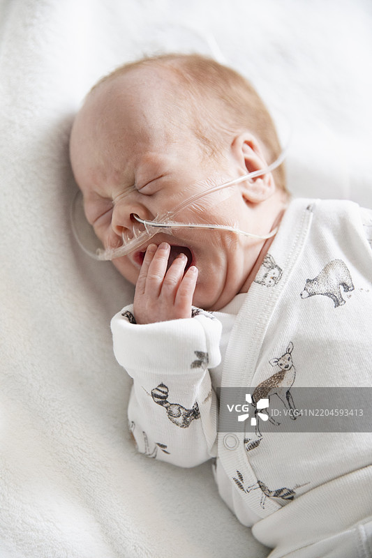 婴儿在床上打哈欠，鼻胃管插入。图片素材