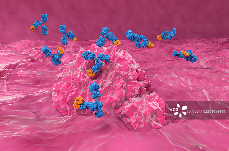 膀胱癌单克隆抗体治疗插图图片素材