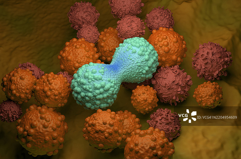 乳腺癌插图图片素材