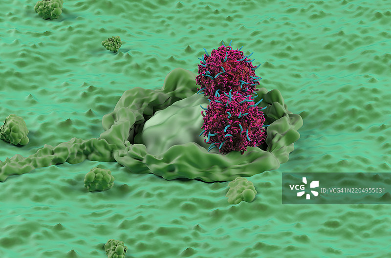 结直肠癌的CAR-T细胞疗法插图图片素材