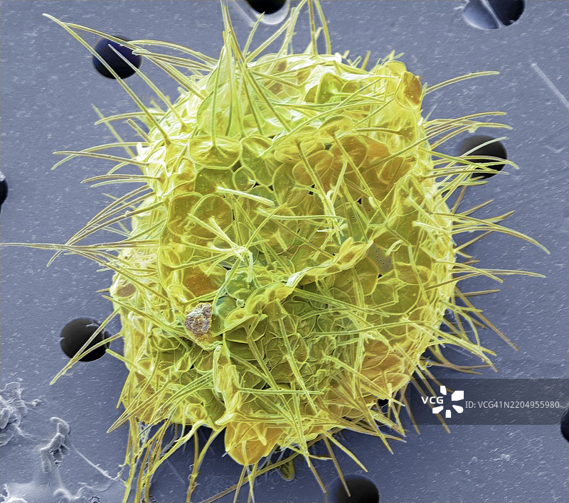 刺囊虫，扫描电子显微镜图像图片素材