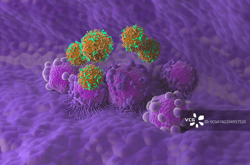 胰腺癌的CAR-T细胞疗法插图图片素材