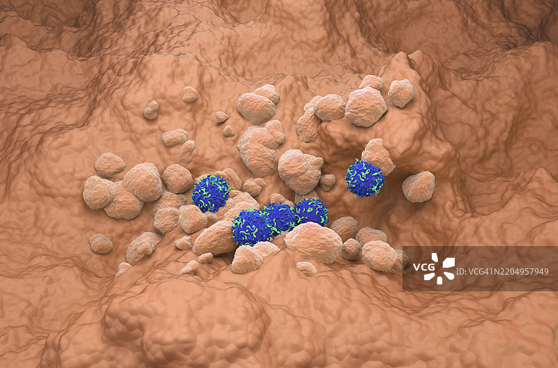 非小细胞肺癌的CAR-T细胞疗法插图图片素材