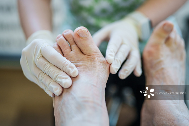 医生检查老年患者的脚部拇外翻（大脚趾外翻）图片素材