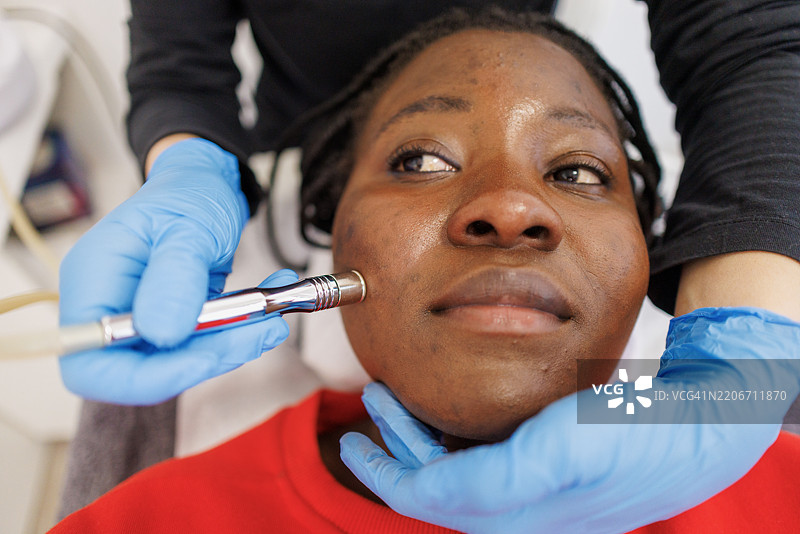 非裔美国女性在进行专业微晶磨皮治疗时放松身心图片素材