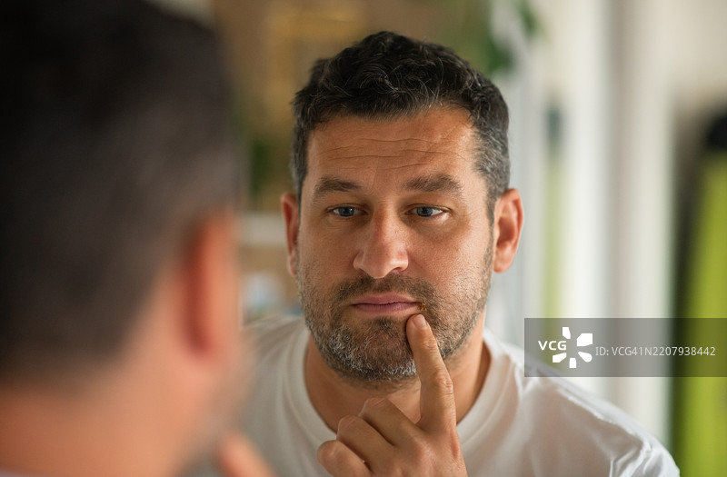 唇部疱疹冷疮图片素材