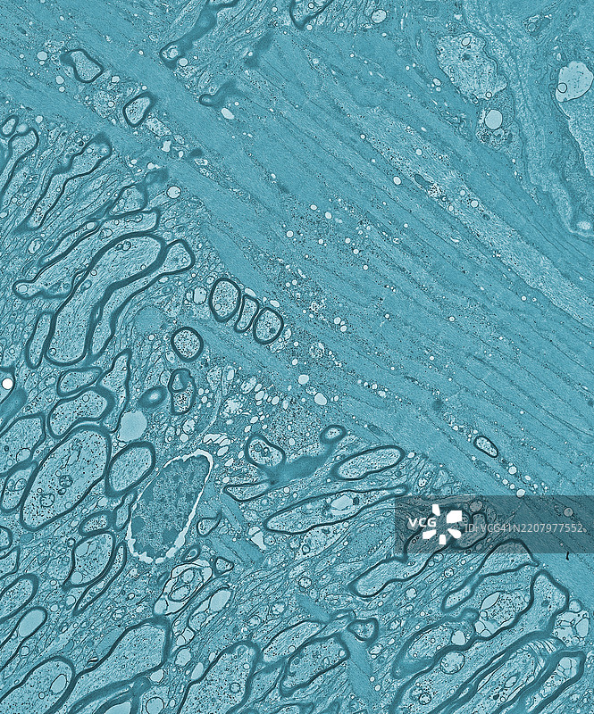 少突胶质细胞，髓鞘，轴突，眼睛，乌龟，透射电子显微镜图片素材