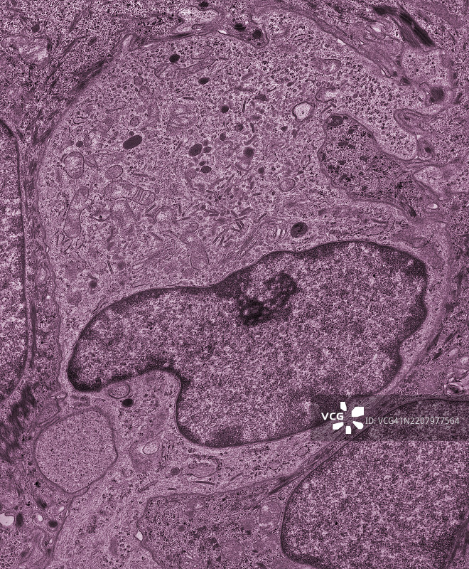 比尔贝克体，比尔贝克颗粒，组织细胞，皮肤，巨噬细胞，免疫，透射电子显微镜图片素材
