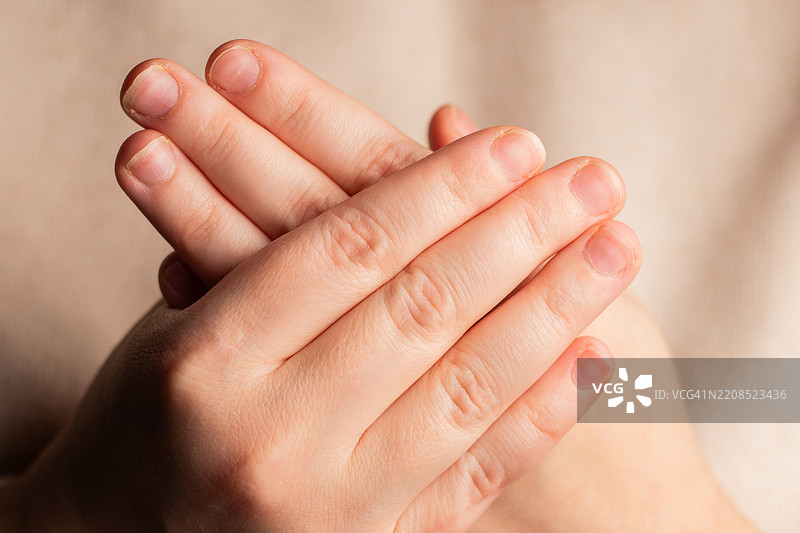 女人展示她的手，指甲被咬得很短，指甲板小，修甲效果差。图片素材