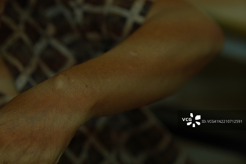 突出的腕骨图片素材