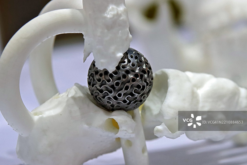 定制化髋关节置换技术图片素材