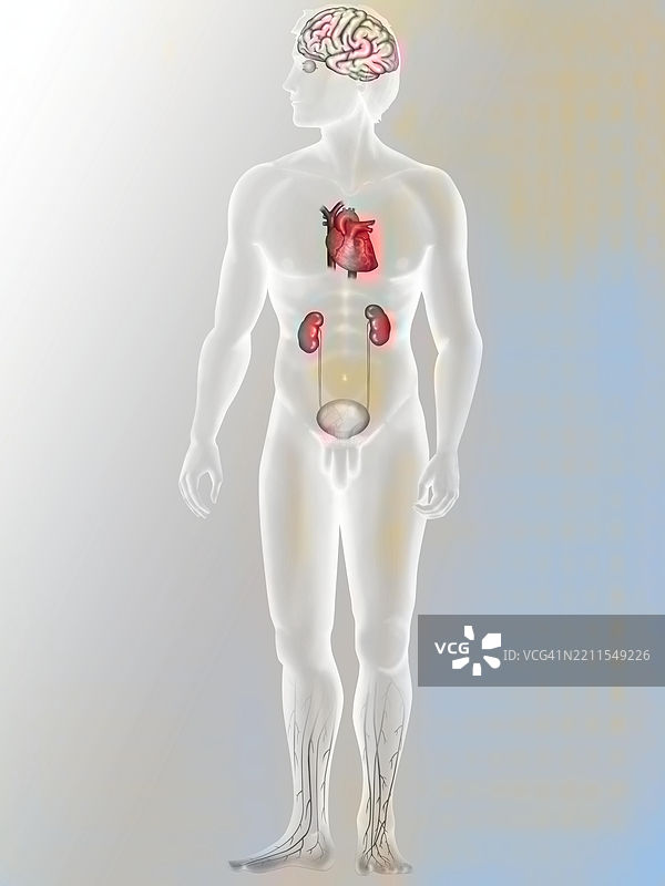 糖尿病的并发症图片素材