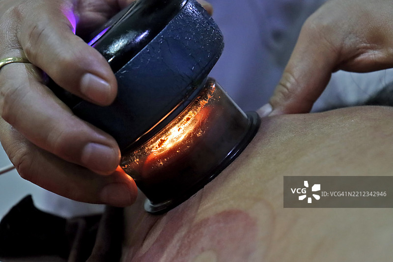 背部或腰部的真空疗法图片素材