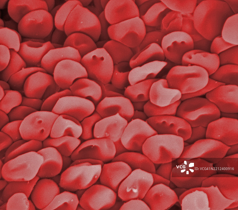 异常红血球，红血球，电子显微镜，扫描电子显微镜，显微镜，红细胞，红血球，变形红细胞症，变形红血球，贫血图片素材