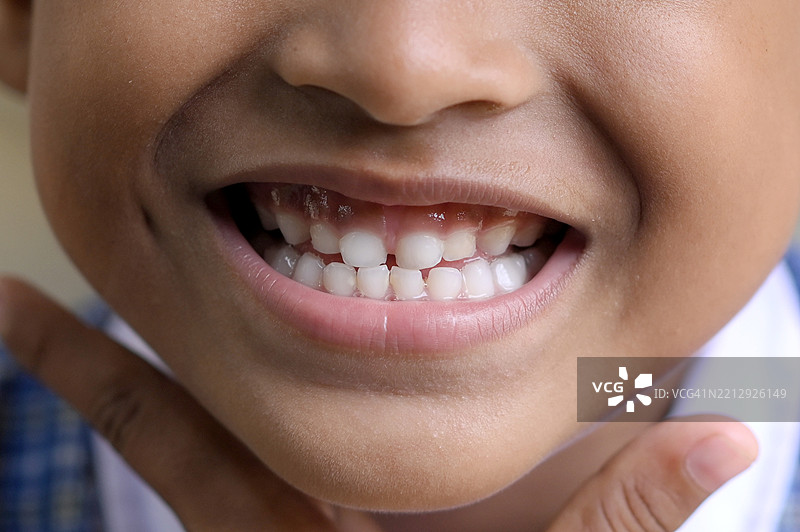 整齐的乳牙特写图片素材