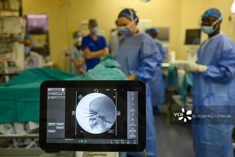 医疗专业人员在医院环境中进行眼部近距离放射治疗手术图片素材