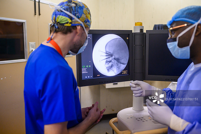 医疗专业人员在医院肿瘤科进行眼部近距离放疗图片素材