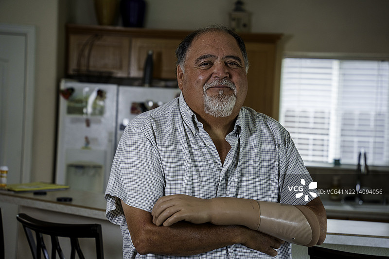 平移镜头展示一位快乐自信的男子，他在手部截肢后佩戴假肢。图片素材