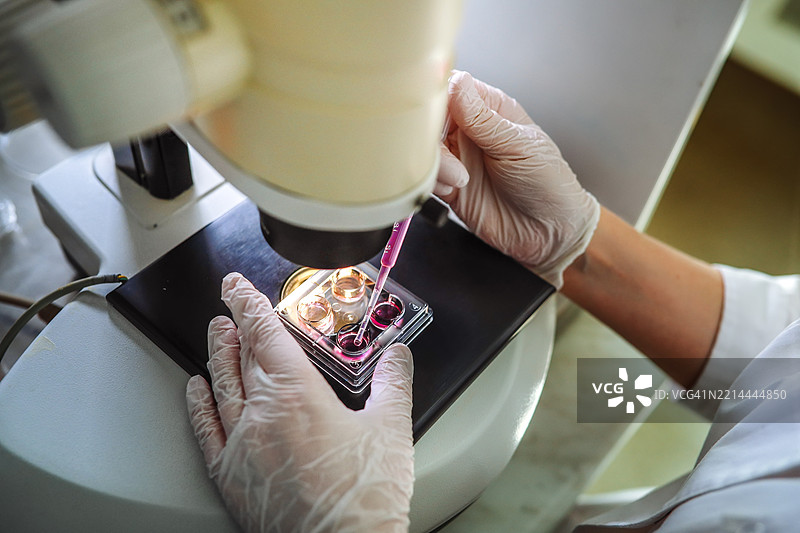 在实验室显微镜下，IVF专家处理四联培养皿中的胚胎图片素材