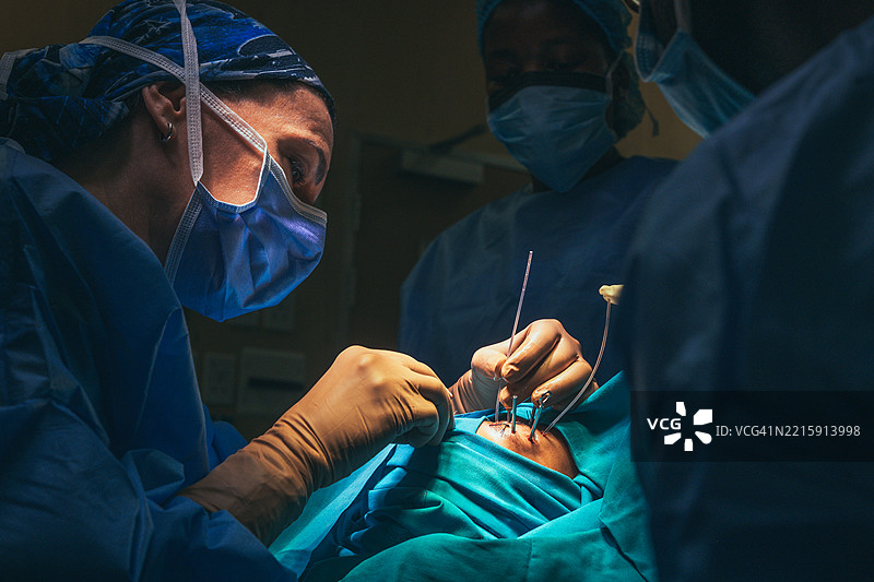 医疗专业人员在医院手术室进行复杂的眼科手术图片素材