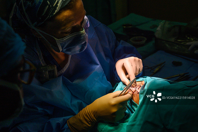 由熟练外科医生进行的眼部近距离放射治疗的肿瘤外科手术图片素材