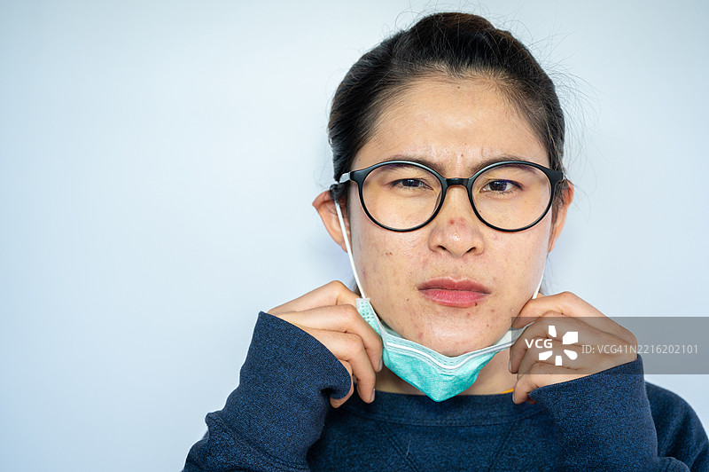 担心的亚洲女性面部有炎症性痤疮的肖像。图片素材