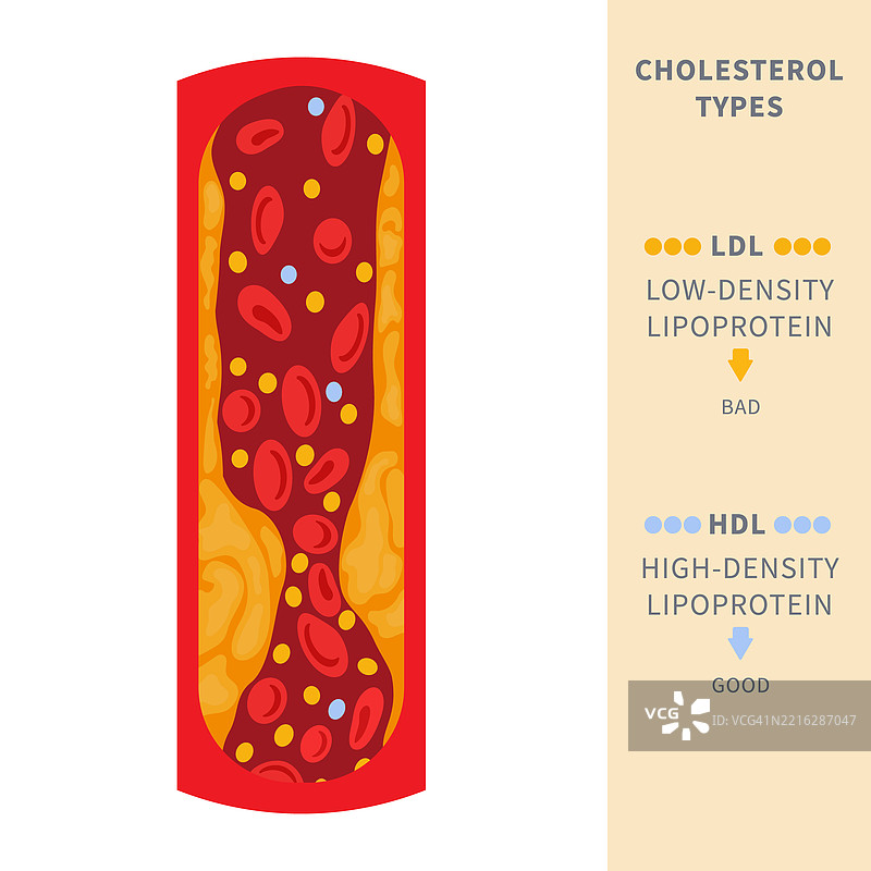 阻塞动脉，概念插图图片素材