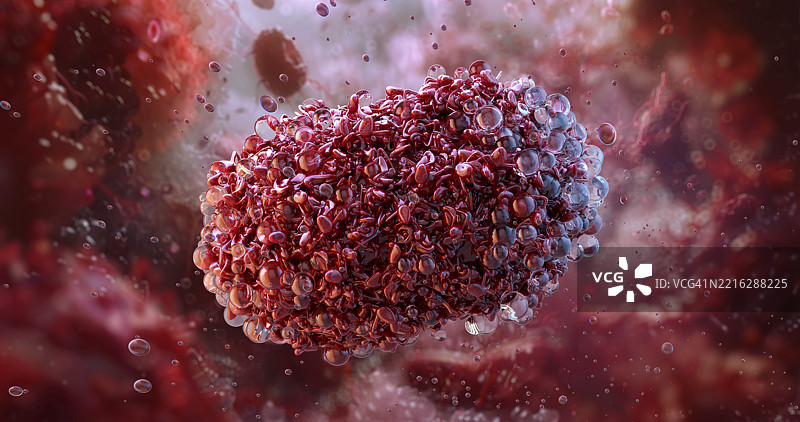 Mpox病毒插图图片素材