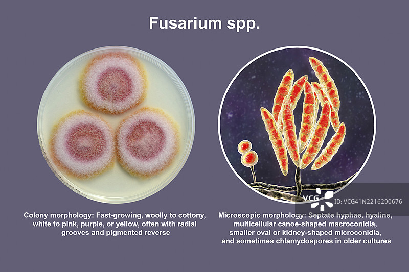 镰刀菌插图图片素材
