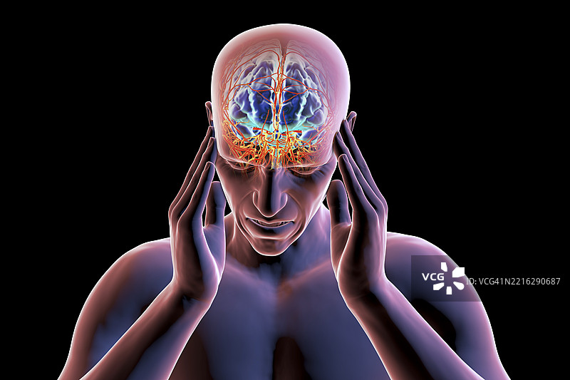 头痛插图图片素材