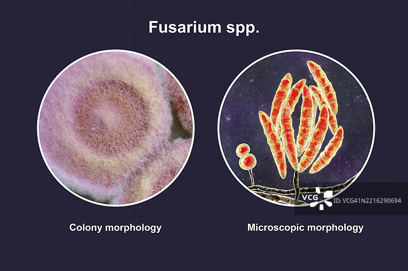 镰刀菌插图图片素材