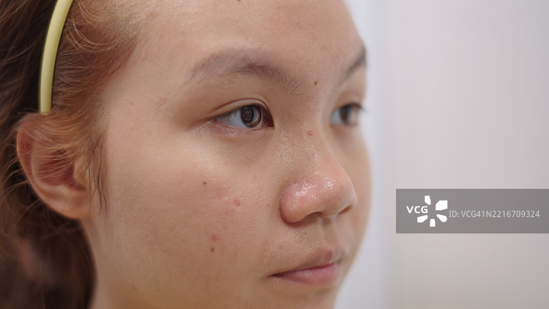 青少年在检查她的面部皮肤。图片素材