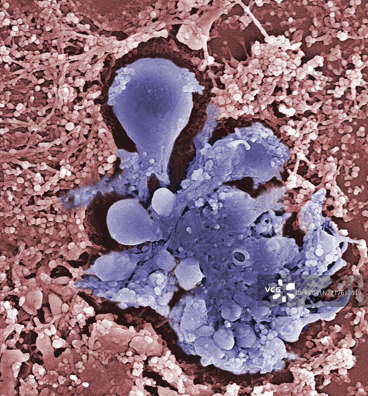 细胞凋亡、细胞死亡、支原体感染的细胞图片素材