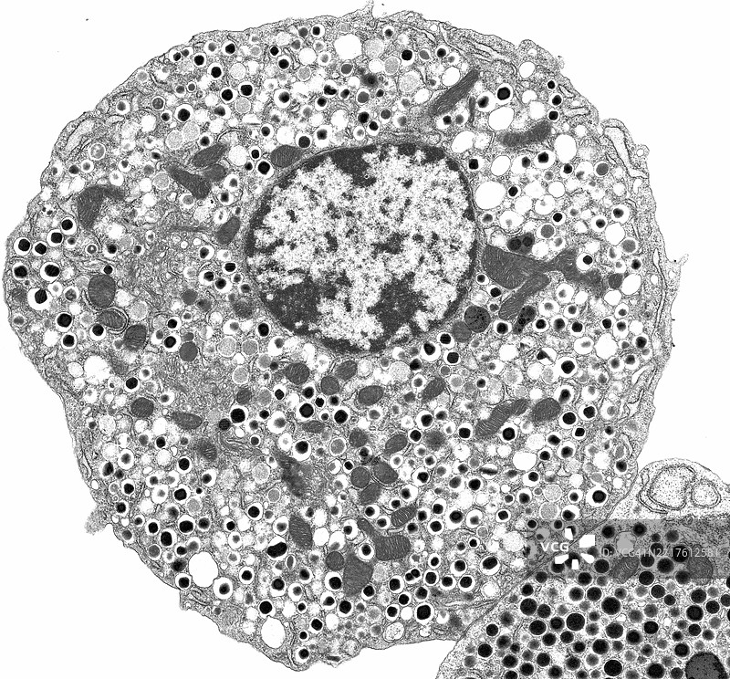 胰岛素，β细胞，胰腺，糖尿病，1型糖尿病图片素材