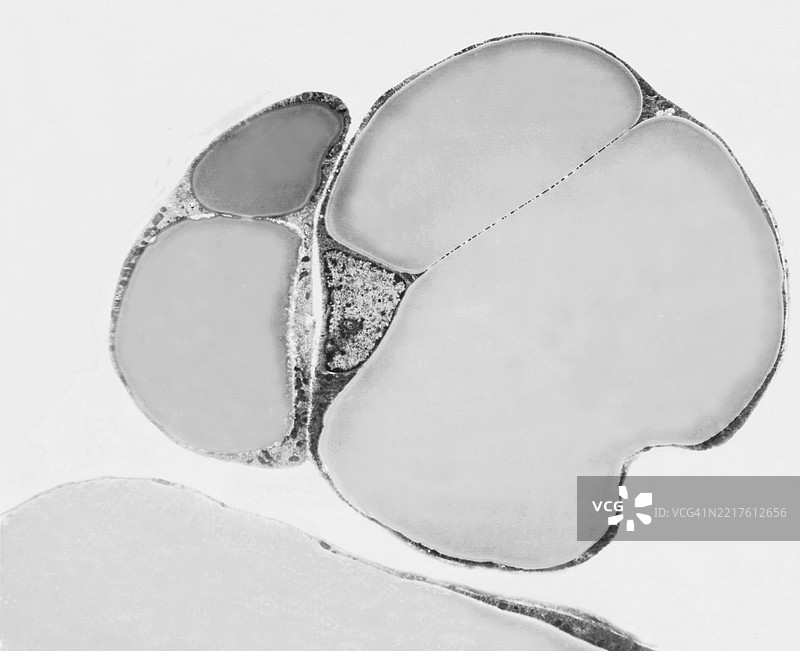 脂肪细胞，糖尿病，肥胖，高血压，储存细胞，脂肪切除术图片素材