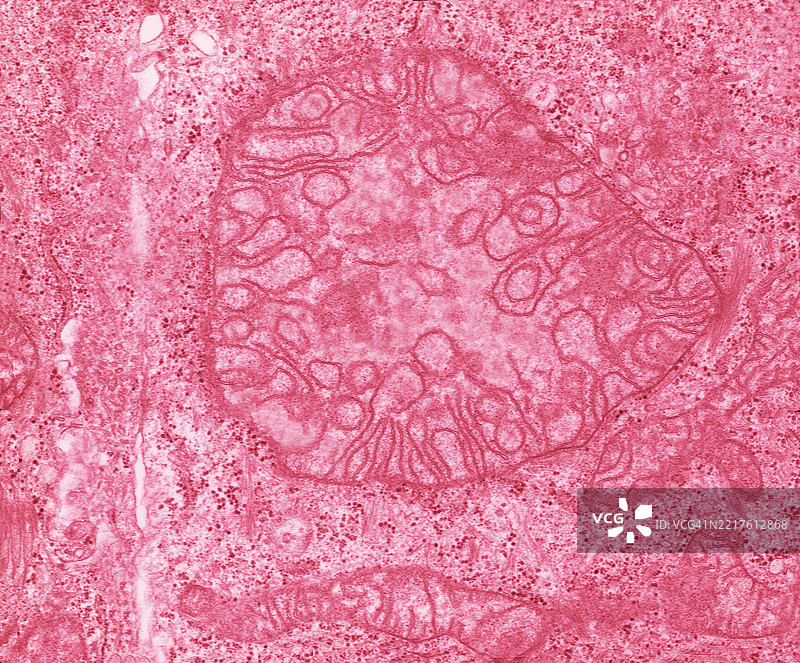 异常的巨型线粒体图片素材