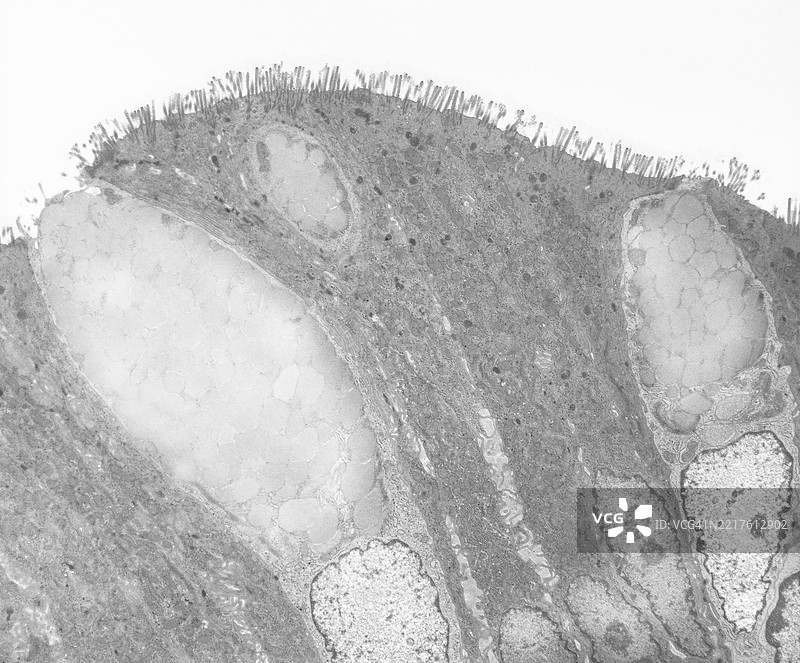 结肠的杯状细胞图片素材