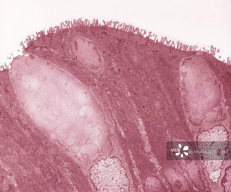 结肠的杯状细胞图片素材