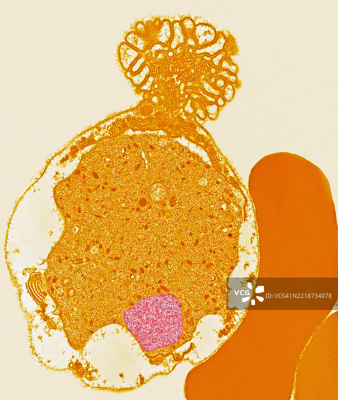 红细胞中的疟疾图片素材