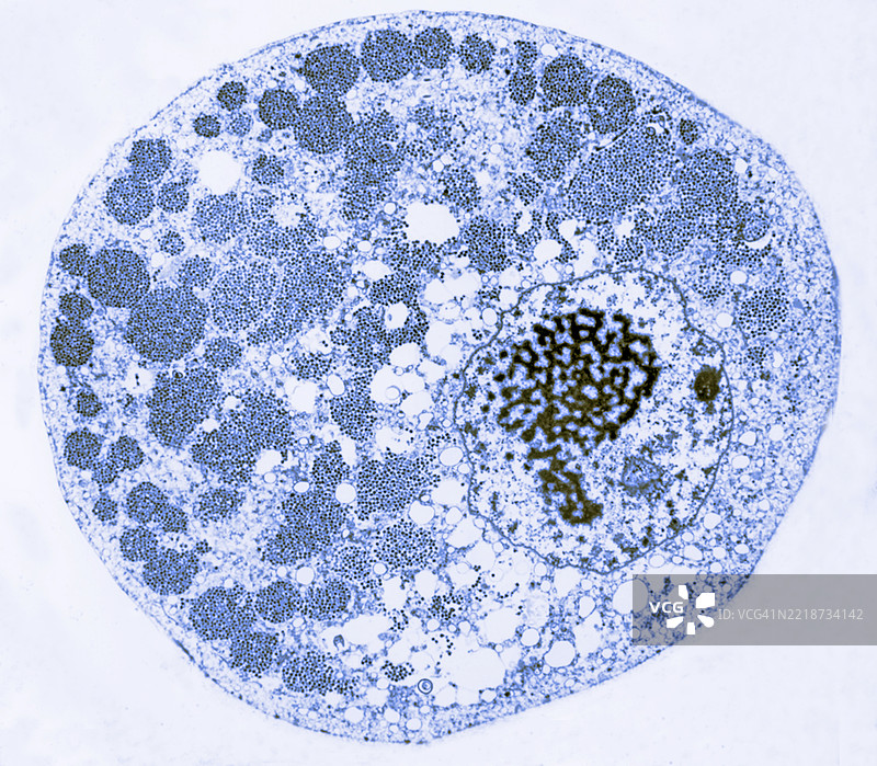 在肾脏远端小管细胞中增殖的巨细胞病毒图片素材