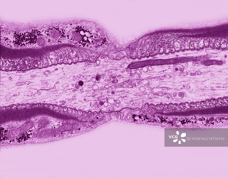 兰维尔结图片素材