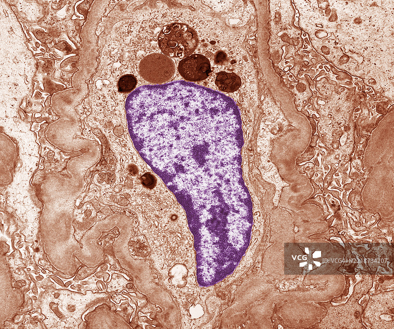 系膜基底膜图片素材