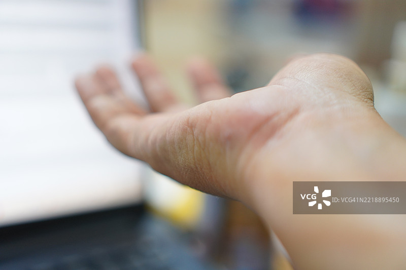 手腕伤口图片素材