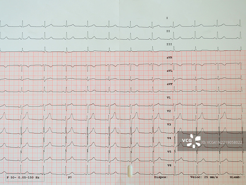 纸质心电图图片素材
