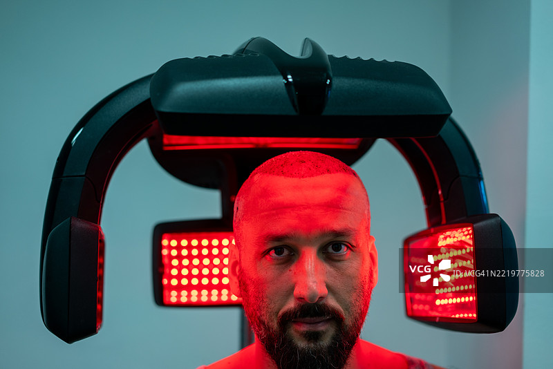 在红外线灯下进行植发前的男性图片素材