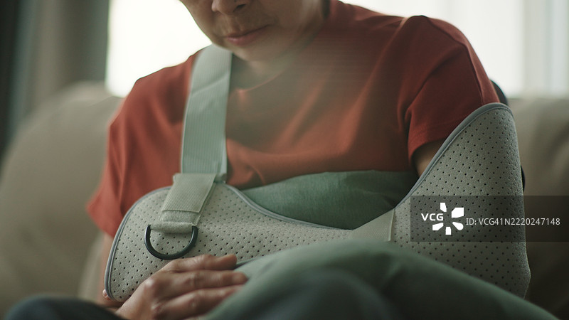 成熟的女性因手臂骨折而戴着石膏绷带。图片素材